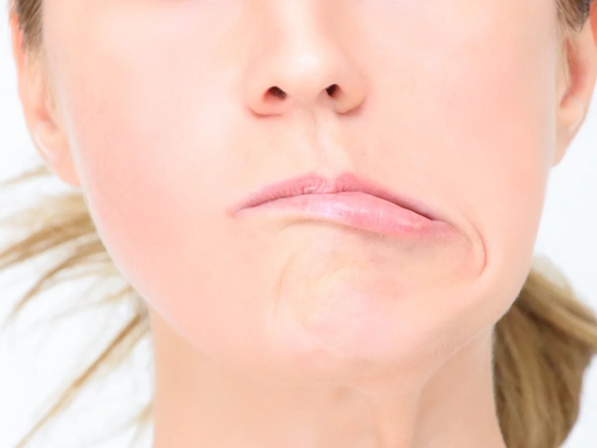 ¿Por qué da parálisis facial? Las causas más frecuentes